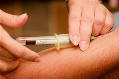 Spinal Needle + Manifattur: Xejriet ta 'l-Industrija U Prospett ta' Sfidi Futuri